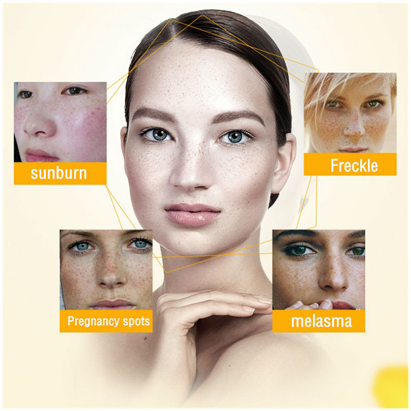 Dimollaure Whitening Freckle C - Retinol Cream review and price