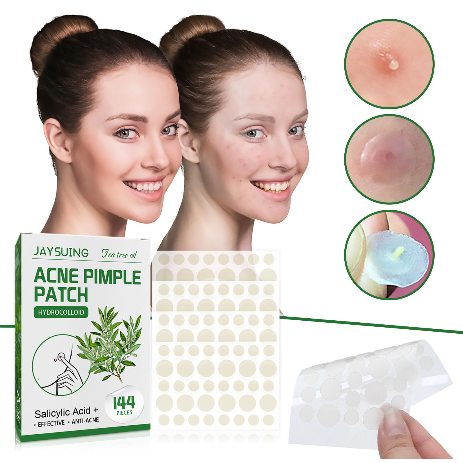 Hydrocolloid Acne Patches - Ab - Face Moisturizer review and price